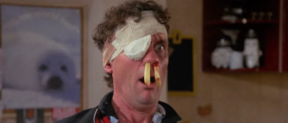Film still from A Fish Called Wanda: a bandaged, one-eyed man reacts in shock with French fries stuck up his nose.